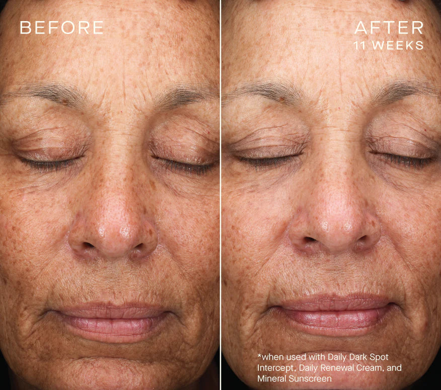 Ourself Daily Dark Spot Intercept 30 mL