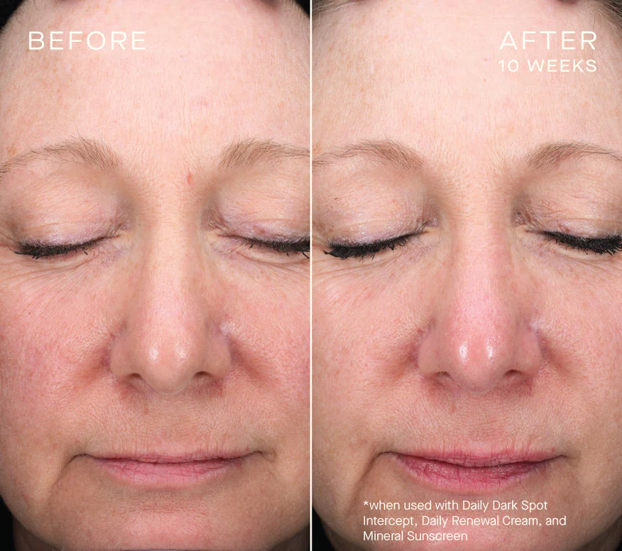 Ourself Daily Dark Spot Intercept 30 mL