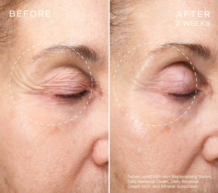 Ourself HA+ Replenishing Serum 30mL