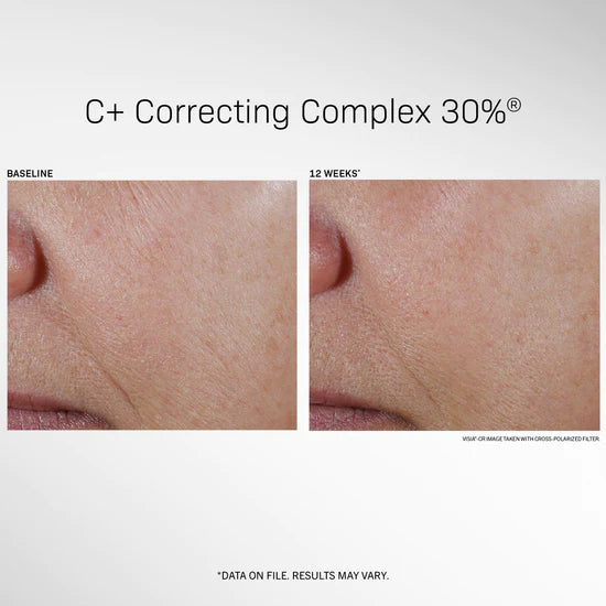 Revision Skincare C+ Correcting Complex 30%® 1 fl oz